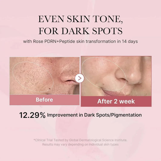 Medicube PDRN Pink Niacinamide Milky Toner 150ml