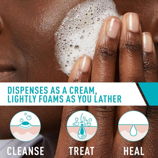 CeraVe Acne Foaming Cream Cleanser with 4% Benzoyl Peroxide – Acne Treatment Face Wash