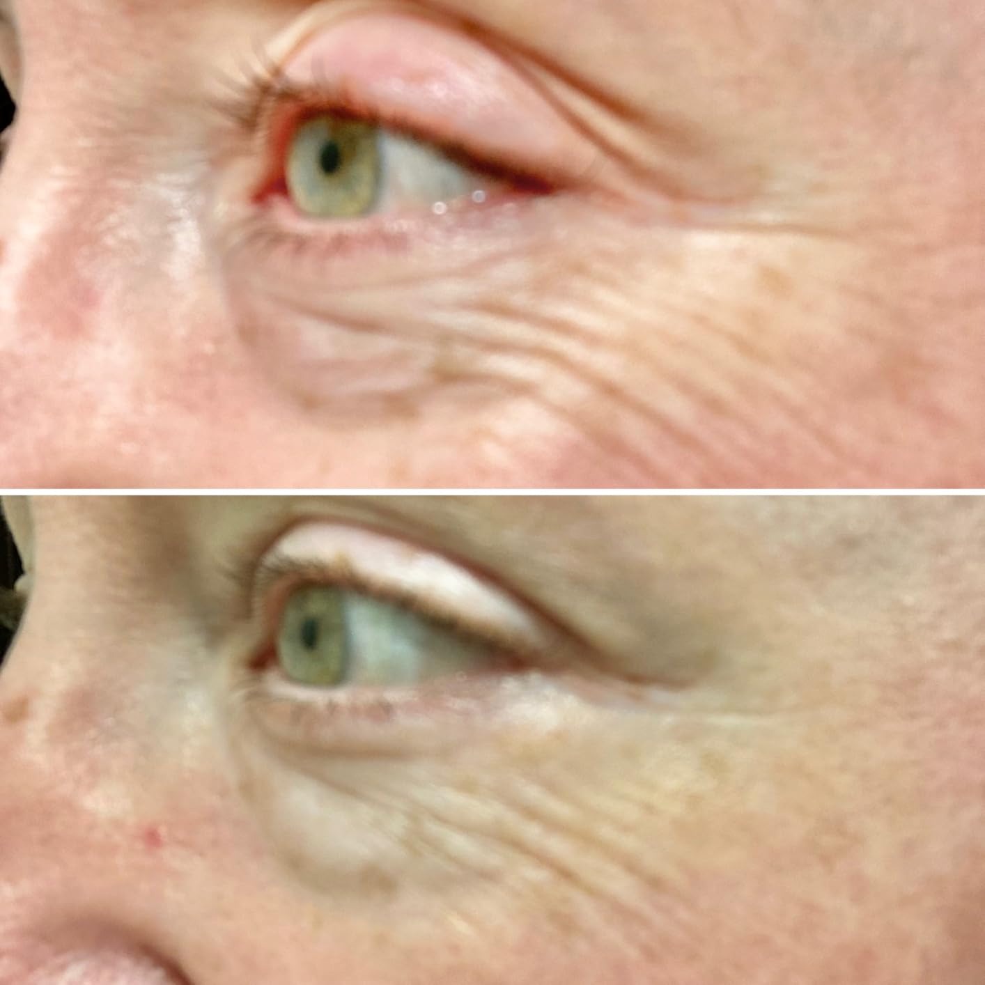 CeraVe Eye Repair Cream – Reduces Dark Circles & Puffiness