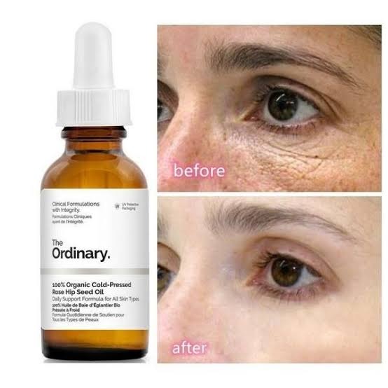 The Ordinary 100% Organic Cold-Pressed Rose Hip Seed Oil 30ml