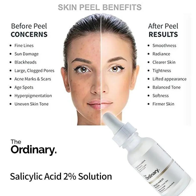 The Ordinary Salicylic Acid 2% Solution
