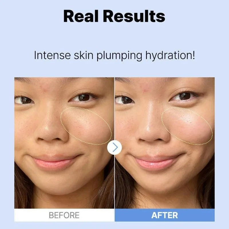 COSRX The Hyaluronic Acid 3 Serum