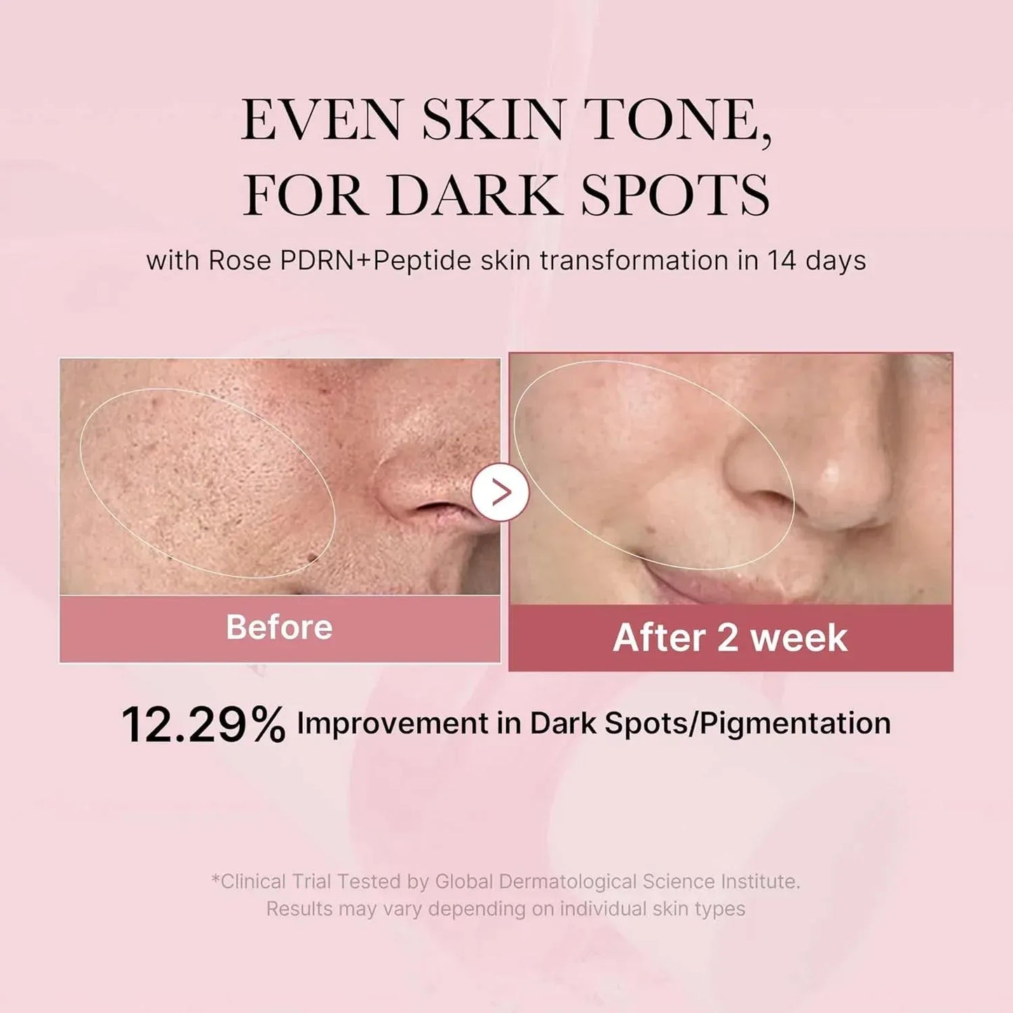 Medicube PDRN Pink Niacinamide Milky Toner 150ml