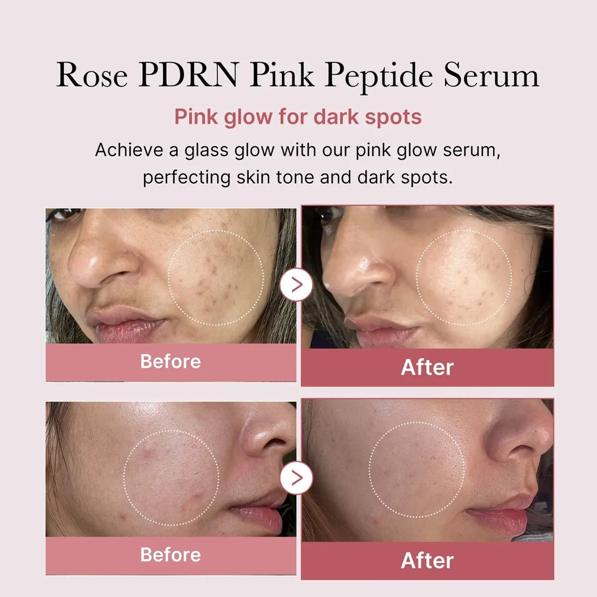 Medicube PDRN Pink Glutathione Serum Mist 100ml