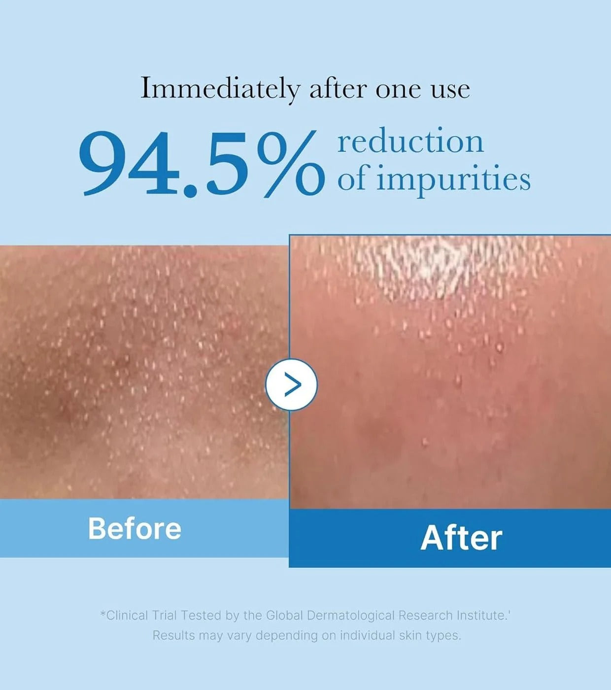 Medicube Zero Pore Cleansing Oil 205ml