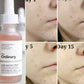 The Ordinary Lactic Acid 10% + HA