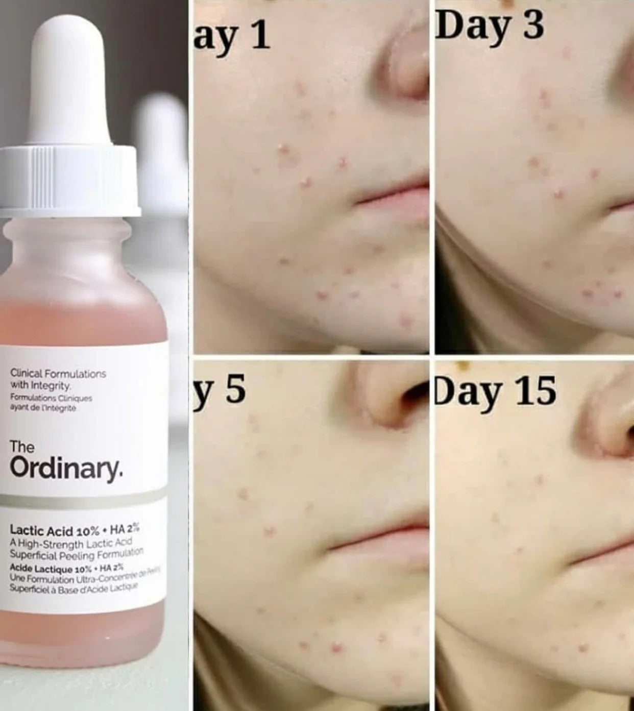 The Ordinary Lactic Acid 10% + HA