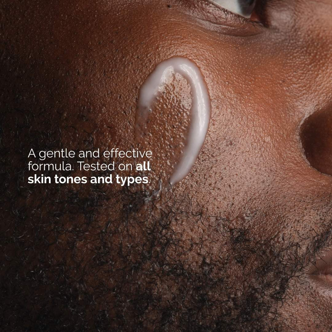 The Ordinary Niacinamide 5% Face & Body Care Emulsion