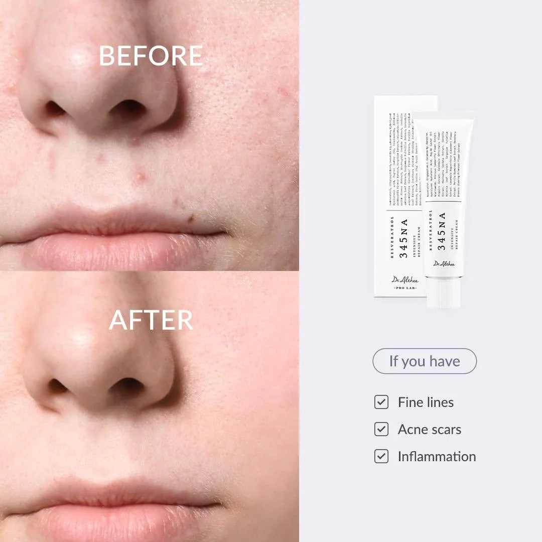 Dr. Althea 345 Relief Face Cream 50ml