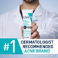CeraVe Acne Foaming Cream Cleanser with 4% Benzoyl Peroxide – Acne Treatment Face Wash