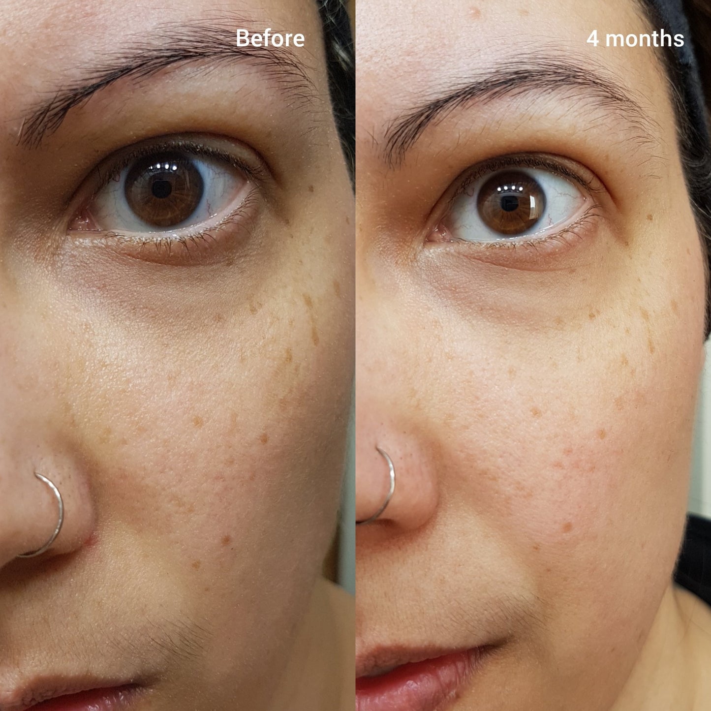 The Ordinary Retinol 1% in Squalane