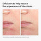 The Ordinary Salicylic Acid 2% Solution