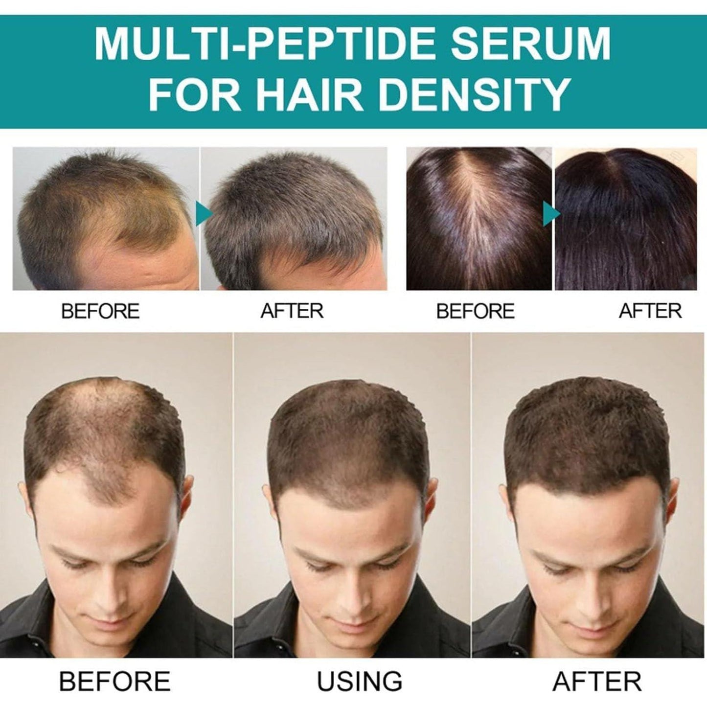 The Ordinary Multi-Peptide Serum for Hair Density