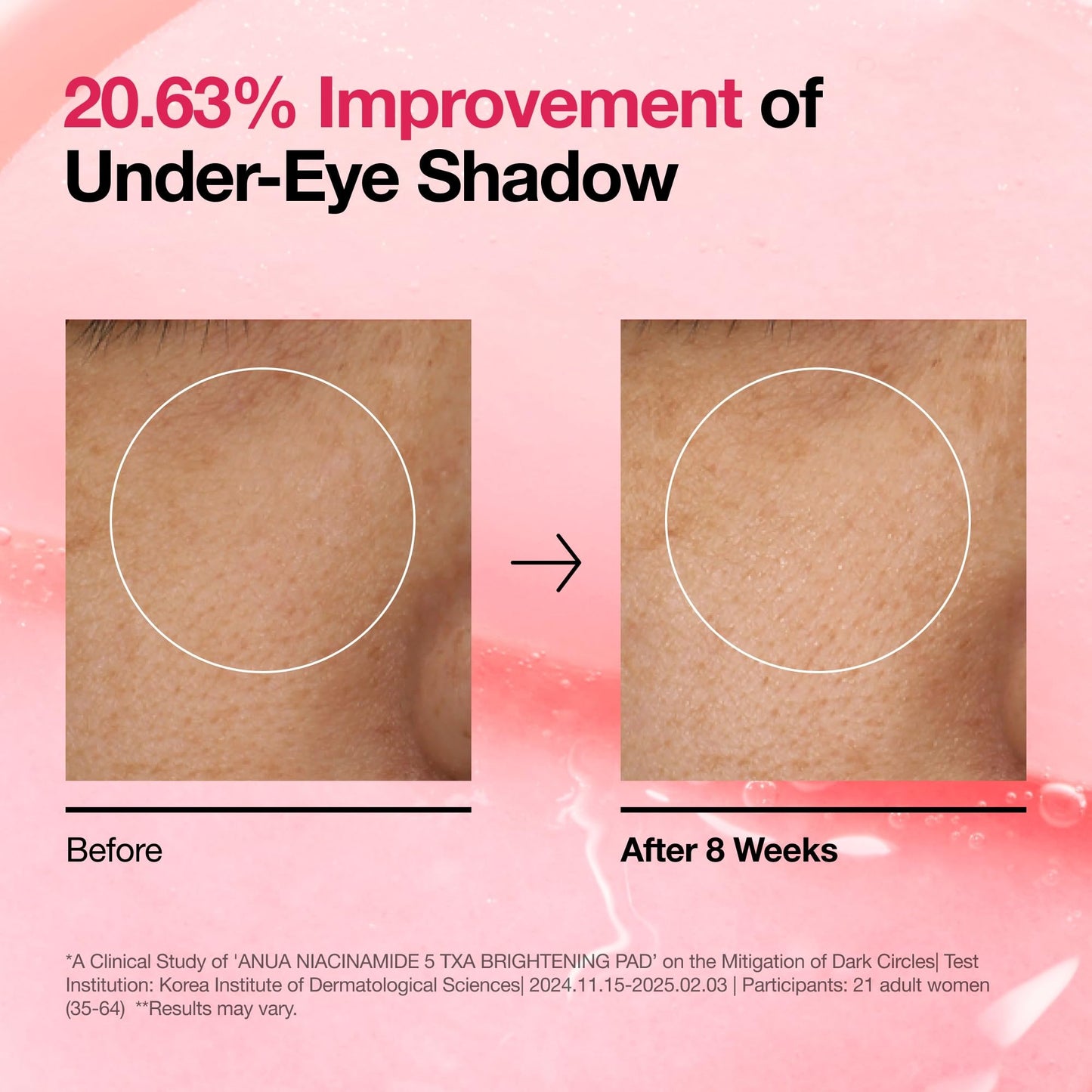 Anua Niacinamide New 10% + TXA 4% Dark Spot Correcting Serum
