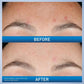 CeraVe Resurfacing Retinol Serum – Smooths Skin Texture & Minimizes Pores