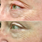 CeraVe Eye Repair Cream – Reduces Dark Circles & Puffiness